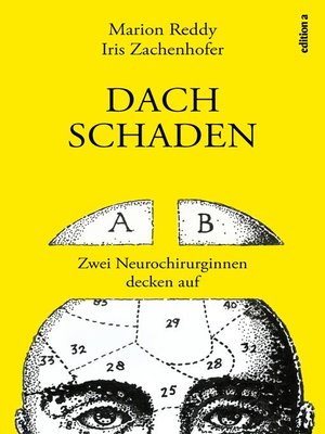 cover image of Dachschaden